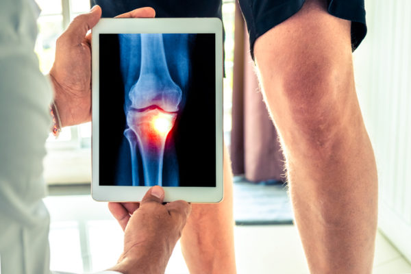 orthopedic surgeon in Long Island uses a tablet to look at an x-ray of a patient who needs a total knee replacement. 